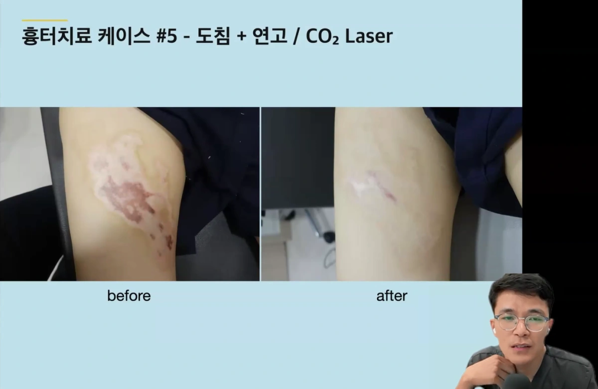 You are currently viewing [2025-06-10] 대한통합레이저의학회 2025 제1차 웨비나
