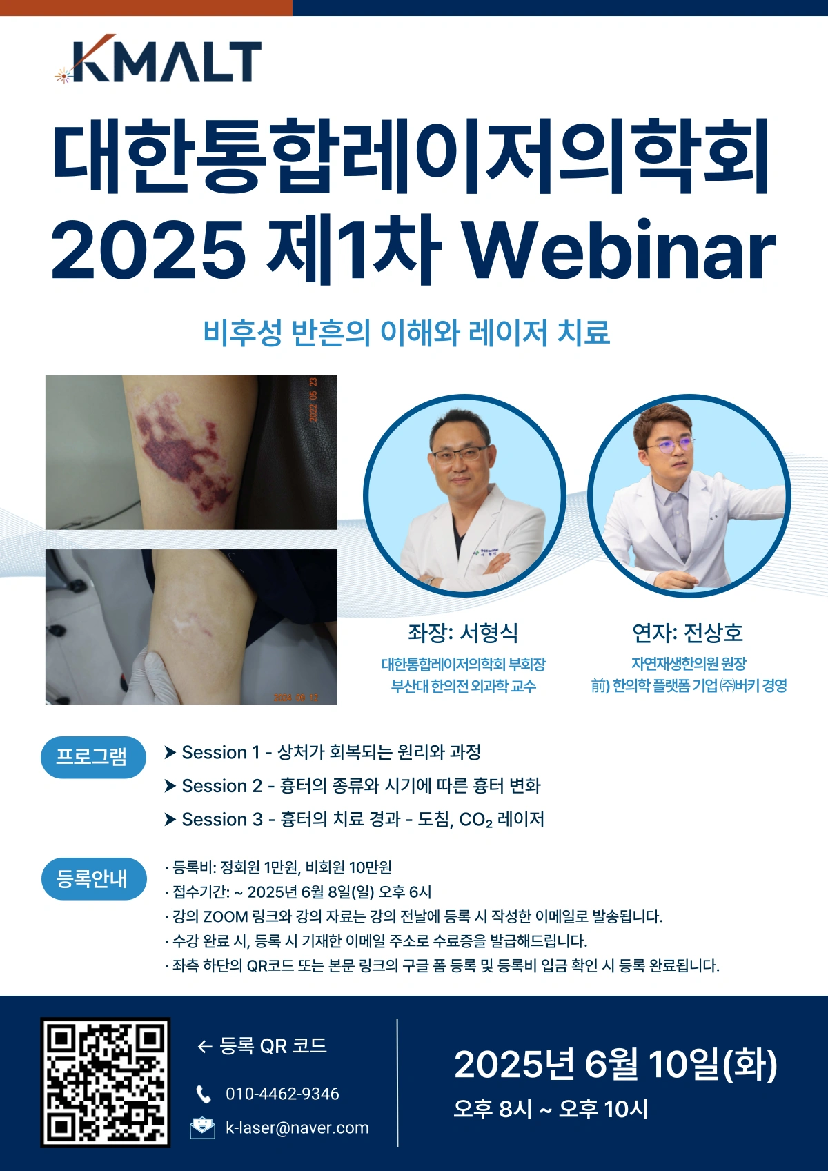 대한통합레이저의학회 2025 제1차 웨비나 「비후성 반흔의 이해와 레이저 치료」 포스터